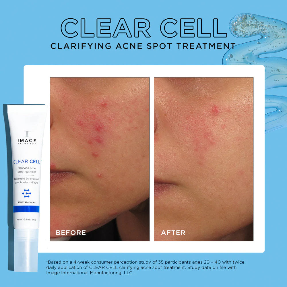 Clear Cell Clarifying Acne Spot Treatment